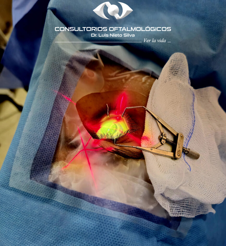 Imagen en quirófano, realizando Crosslinking